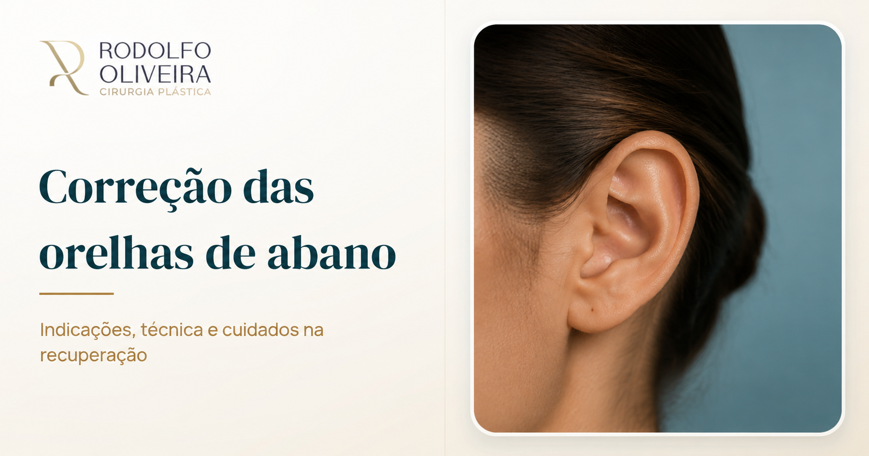Tudo o que você precisa saber sobre a cirurgia de correção das orelhas de abano