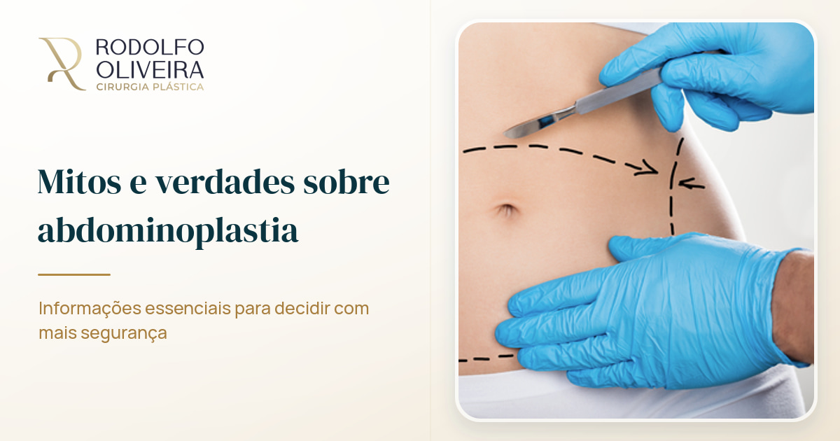 Imagem de capa do artigo Mitos e verdades sobre abdominoplastia