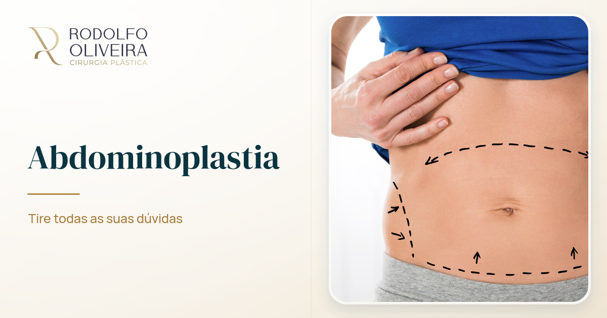 Imagem de capa do artigo Abdominoplastia: Tire todas as suas dúvidas