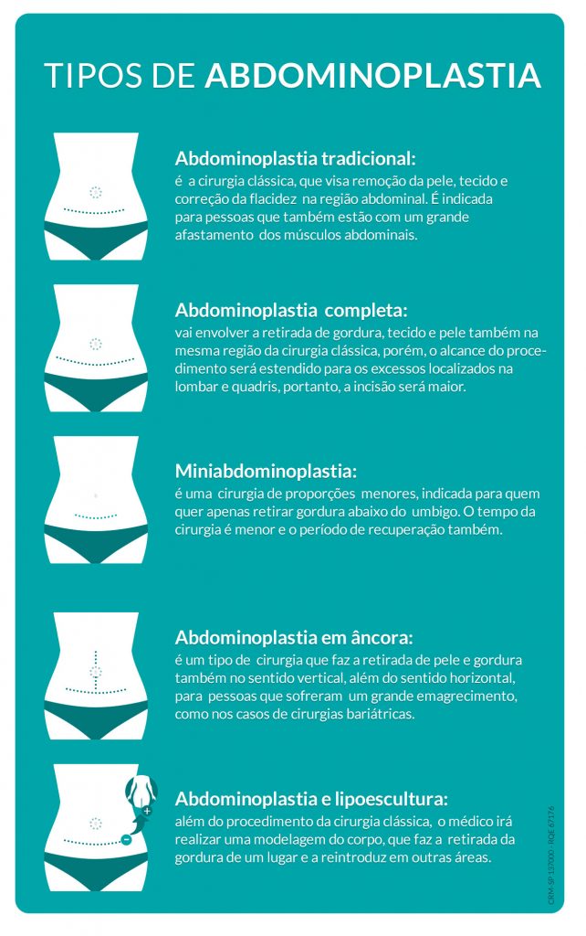 Abdominoplastia e lipoescultura: qual a diferença entre os procedimentos? Abdominoplastia e lipoescultura: qual a diferença entre os procedimentos?