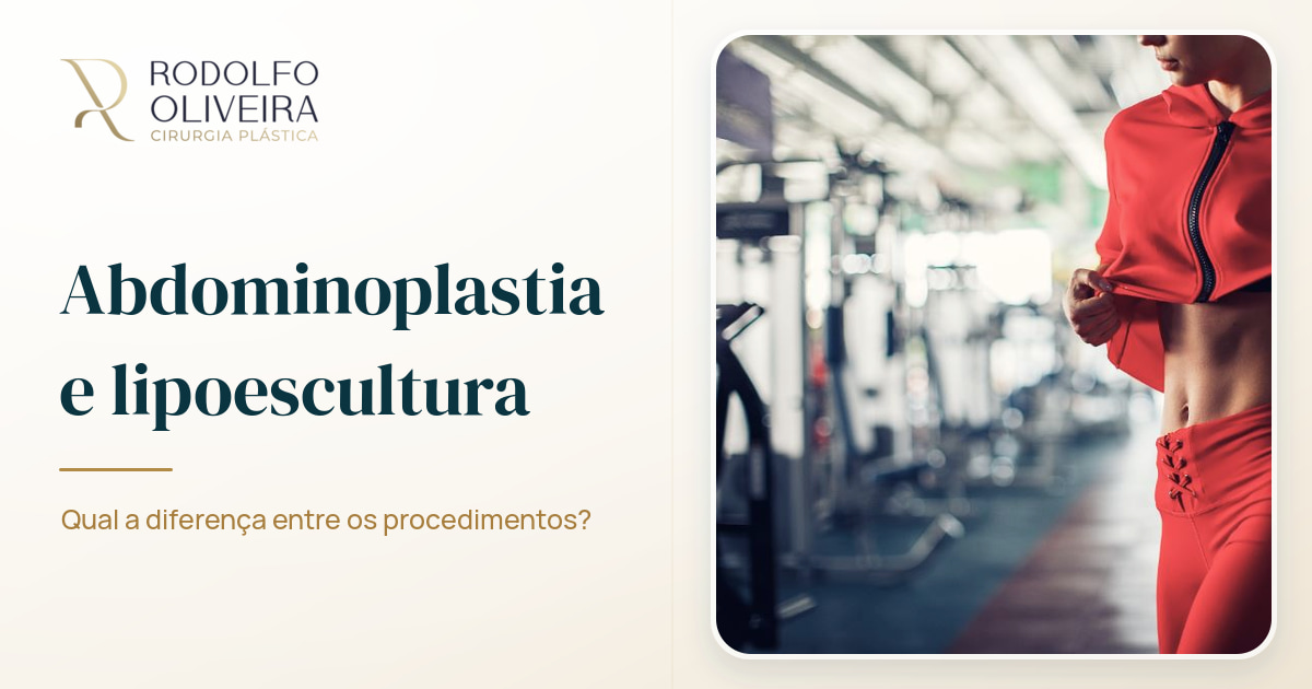 Imagem de capa do artigo Abdominoplastia e lipoescultura: qual a diferença entre os procedimentos?