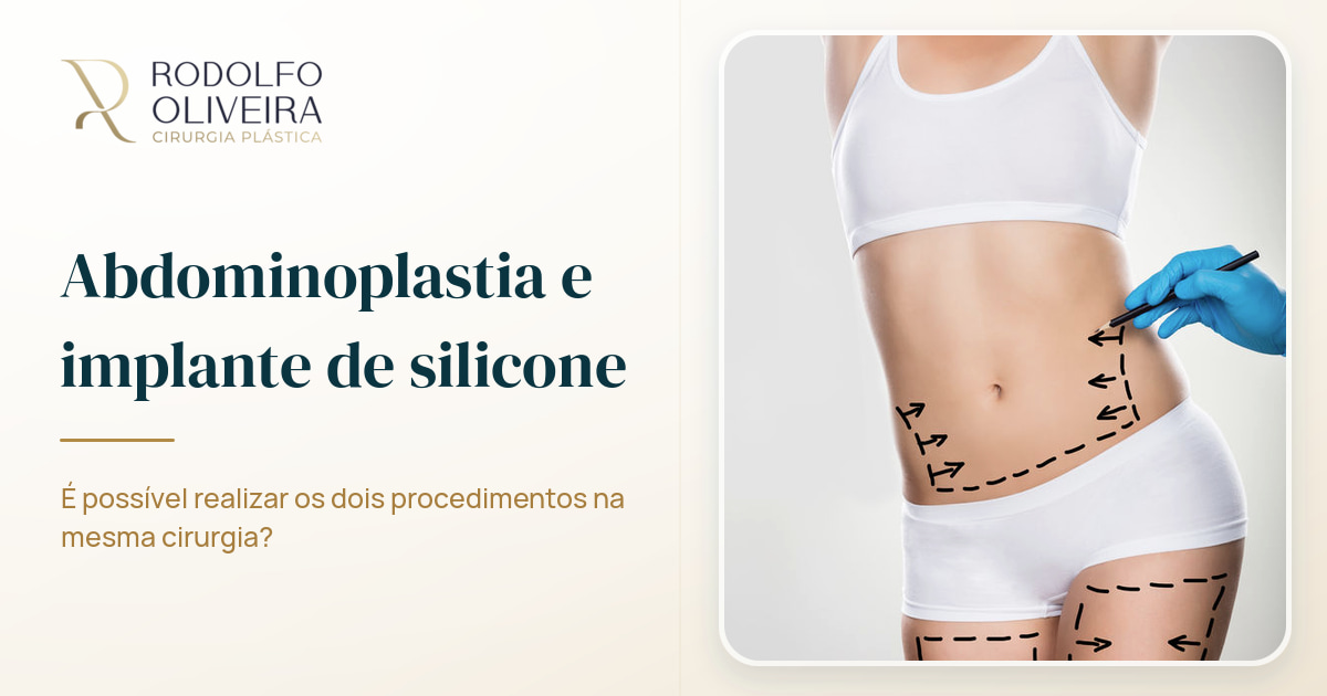Imagem de capa do artigo Posso fazer a abdominoplastia e o implante de silicone na mesma cirurgia?
