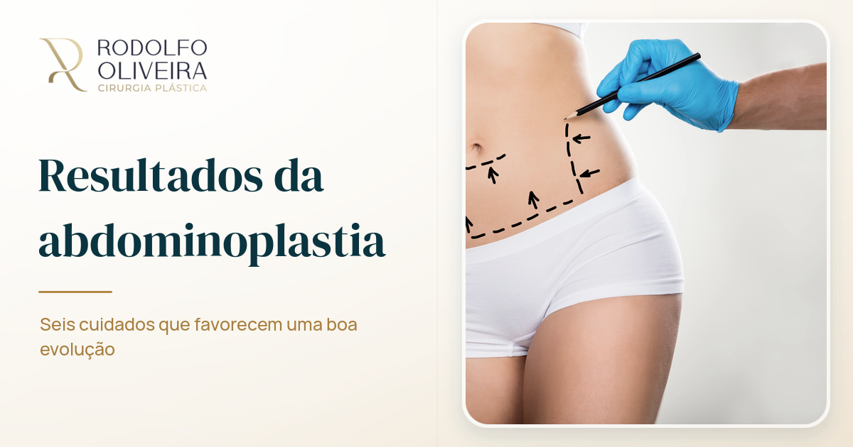 Imagem de capa do artigo 6 dicas para um bom resultado na abdominoplastia