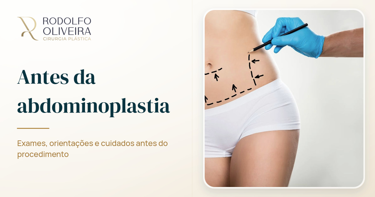 Imagem de capa do artigo 7 coisas que você precisa saber antes de fazer uma abdominoplastia