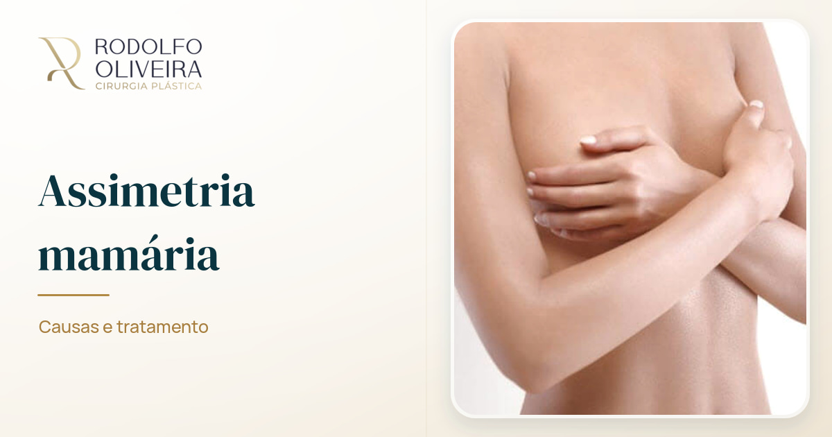 Imagem de capa do artigo Assimetria mamária: Causas e tratamento