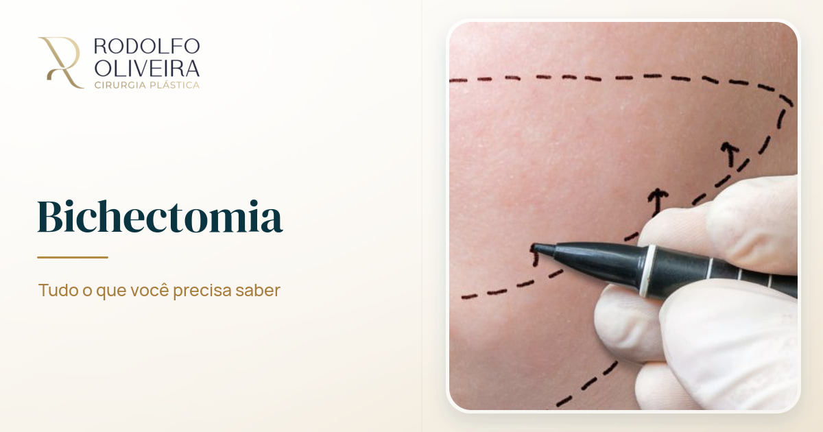Imagem de capa do artigo Bichectomia: Tudo o que você precisa saber