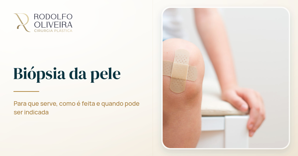 Imagem de capa do artigo Tire suas dúvidas sobre biópsia da pele