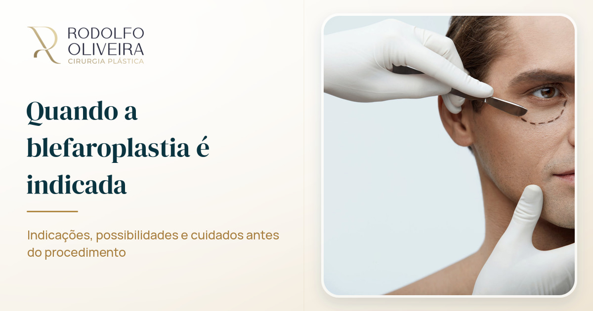 Imagem de capa do artigo Quando a blefaroplastia é indicada?