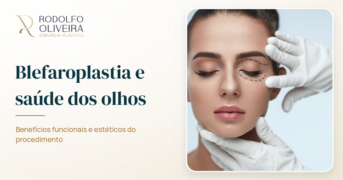 Imagem de capa do artigo Benefícios da blefaroplastia para a saúde dos olhos