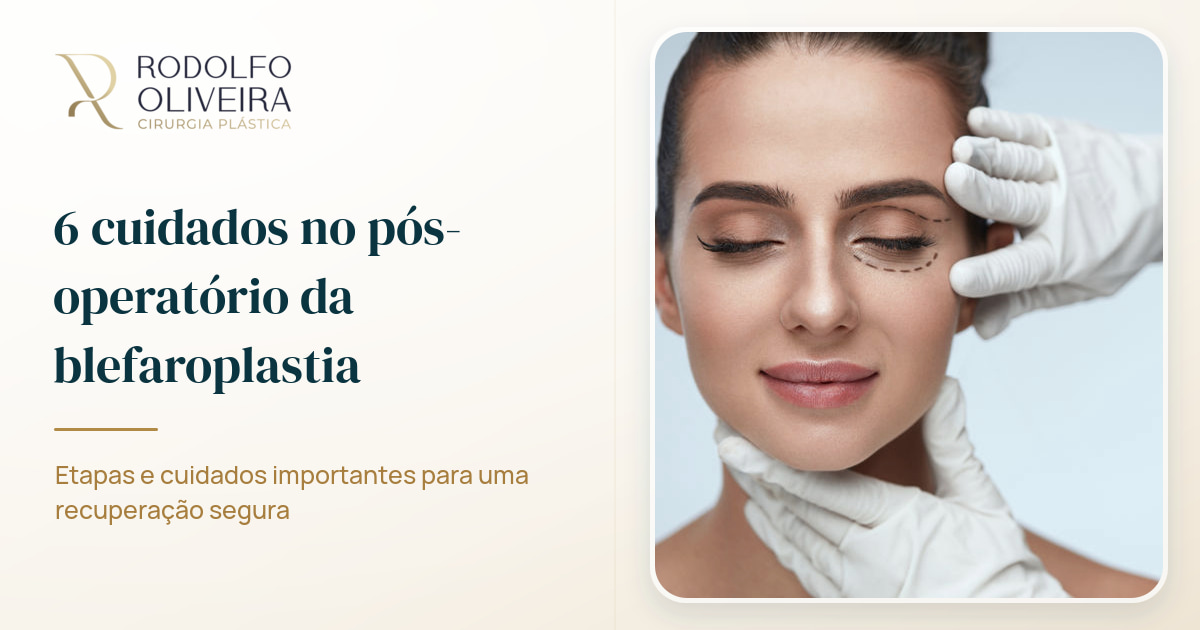 Imagem de capa do artigo 6 cuidados no pós-operatório da blefaroplastia