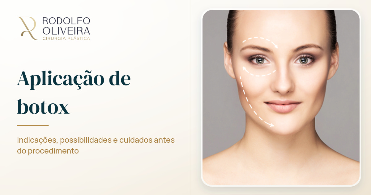 Imagem de capa do artigo Aplicação de botox: quando começar?