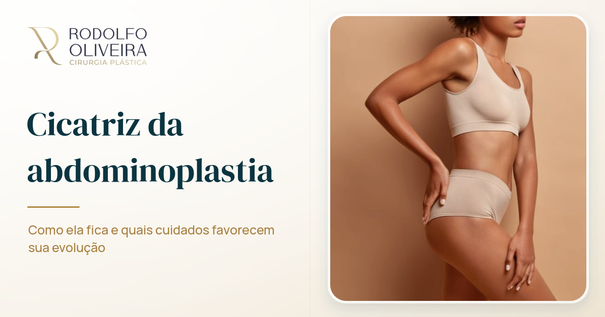Imagem de capa do artigo Cicatriz abdominoplastia: como fica após a cirurgia?