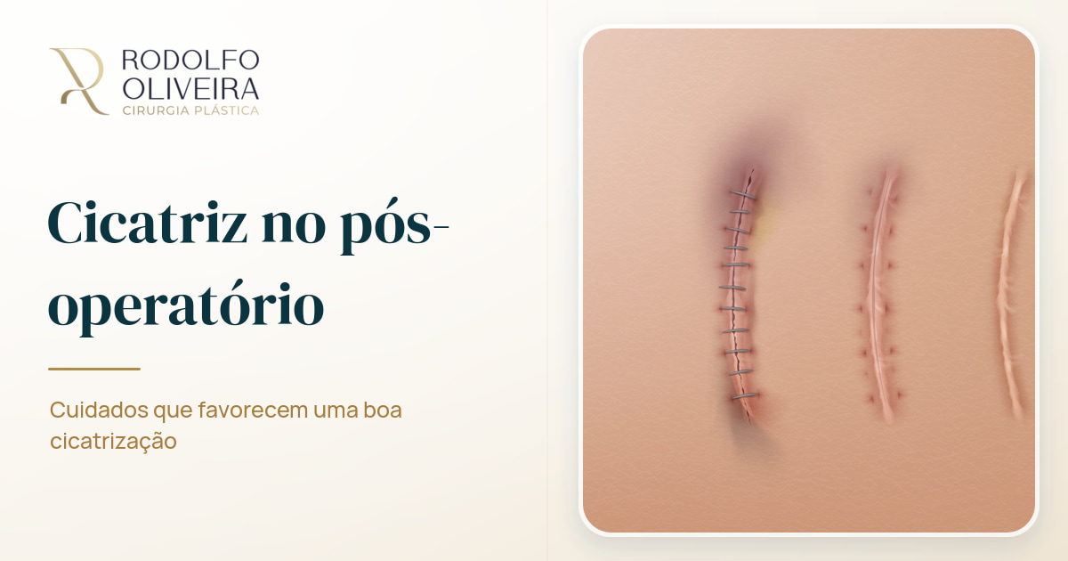 Imagem de capa do artigo Como cuidar da sua cicatriz no pós-operatório