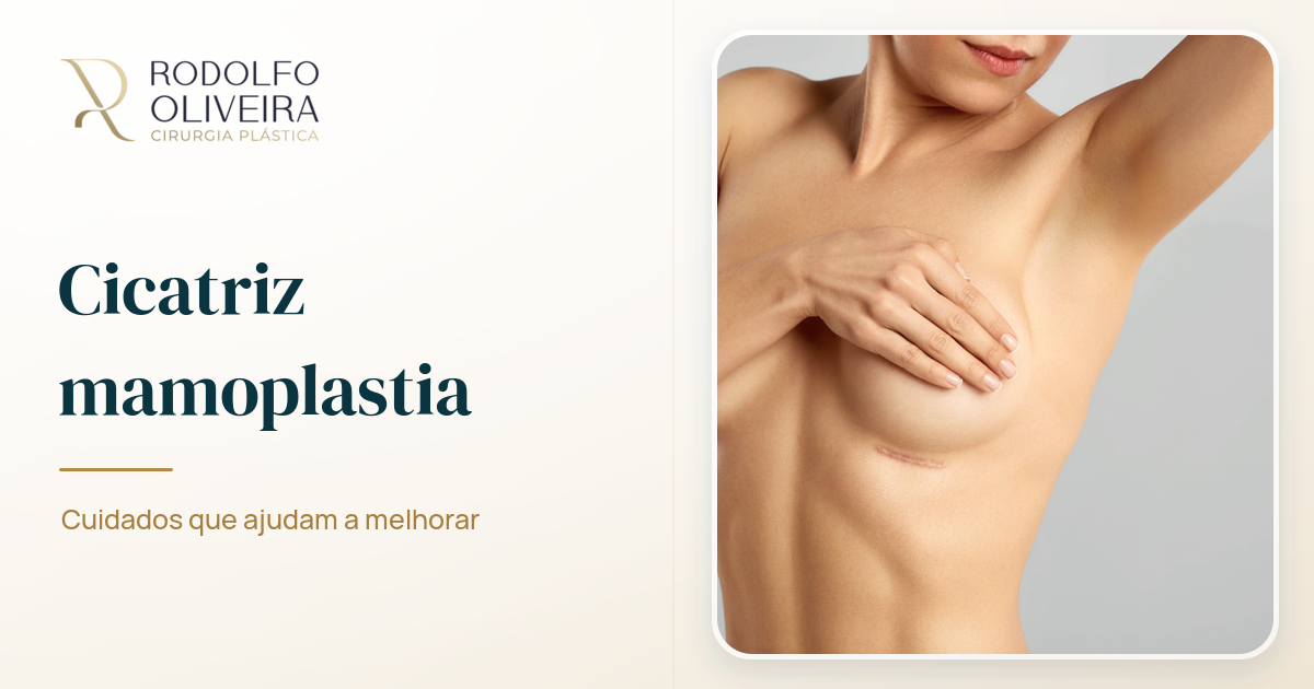 Imagem de capa do artigo Cicatriz mamoplastia: cuidados que ajudam a melhorar