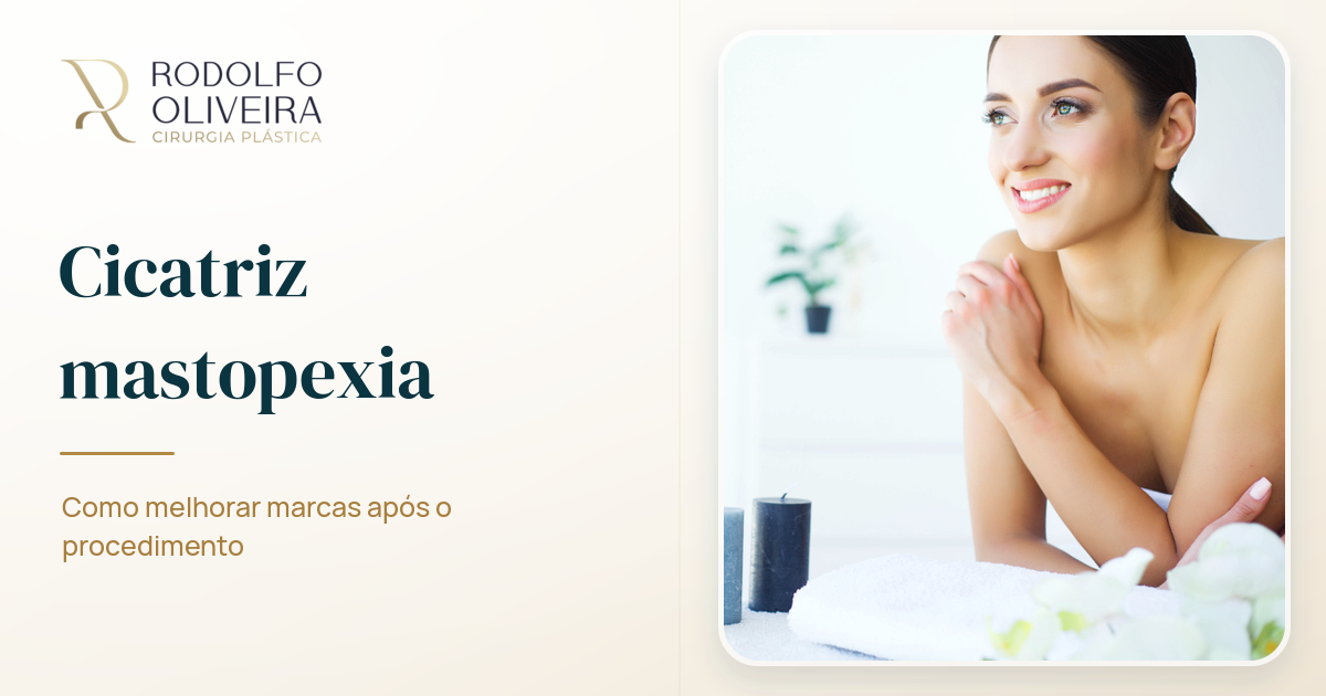 Imagem de capa do artigo Cicatriz mastopexia: como melhorar marcas após o procedimento