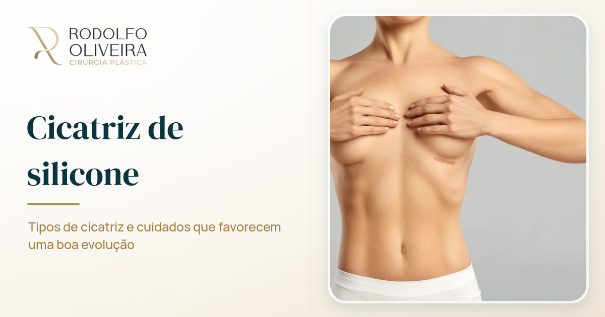 Imagem de capa do artigo Cicatriz silicone: entenda os tipos e cuidados