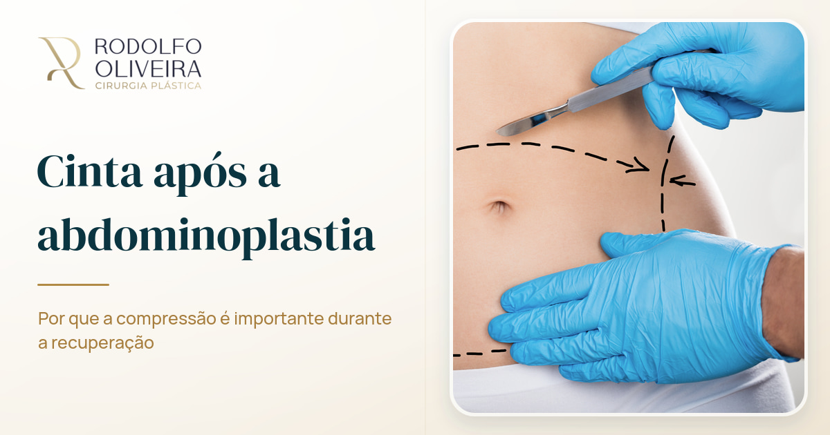 Imagem de capa do artigo Por que é necessário usar cinta modeladora após a abdominoplastia?