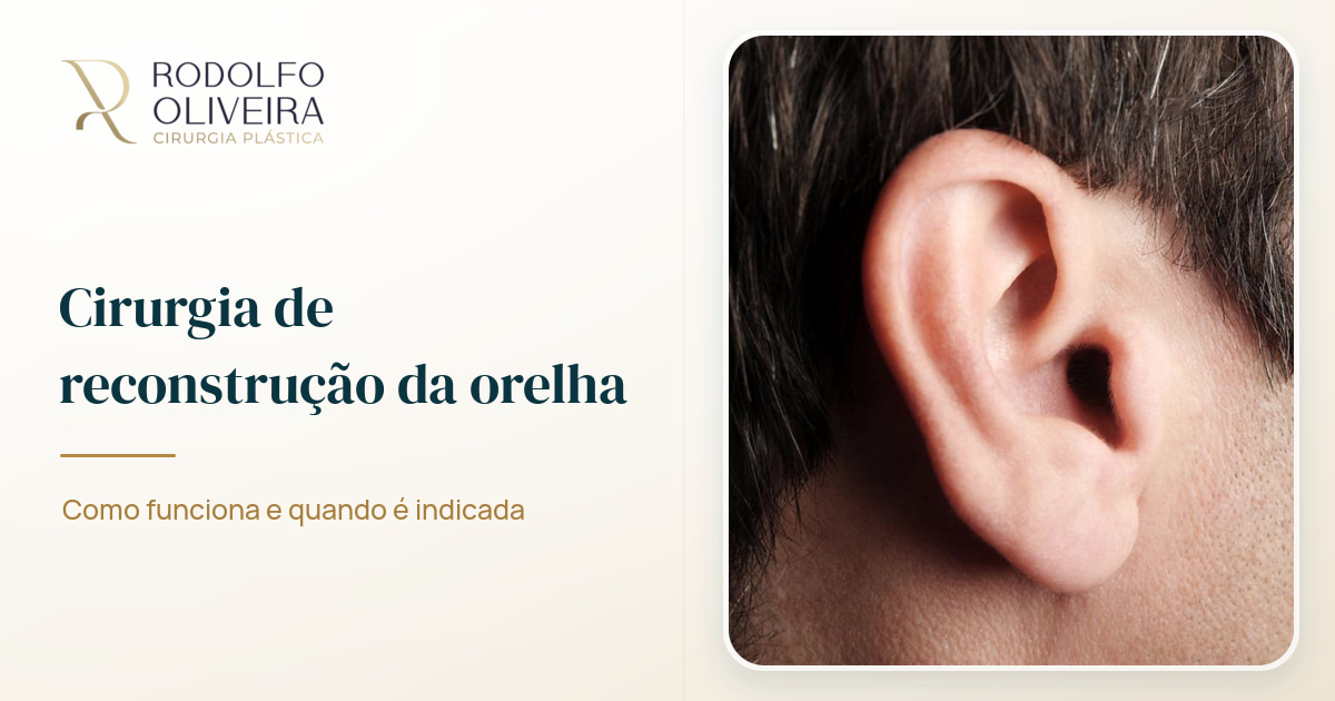 Imagem de capa do artigo Cirurgia de reconstrução da orelha: como funciona e quando é indicada
