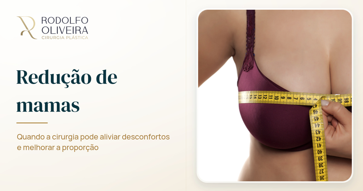Imagem de capa do artigo Sofre com seios grandes? A cirurgia de redução de seios pode te ajudar