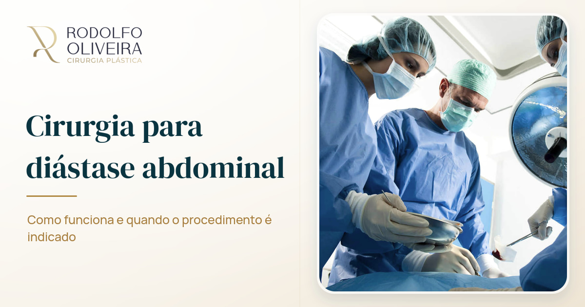 Imagem de capa do artigo Entenda mais sobre a cirurgia para eliminação da diástase abdominal