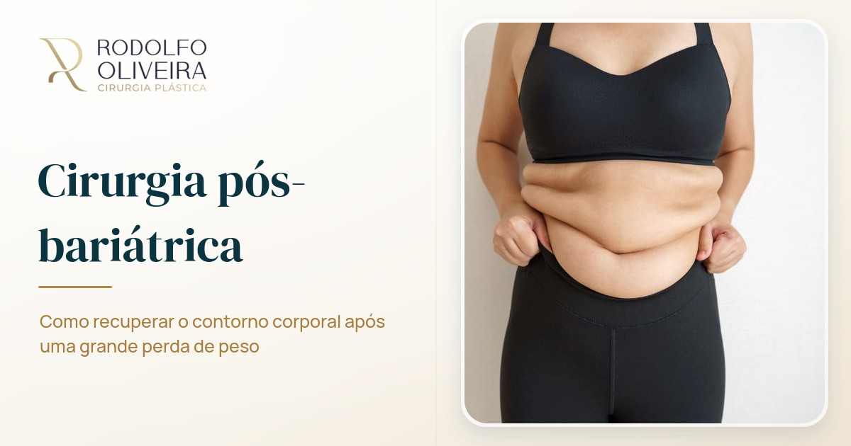Imagem de capa do artigo Cirurgia pós-bariátrica: entenda como harmonizar a silhueta