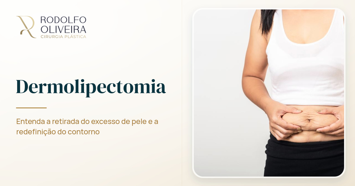 Imagem de capa do artigo Dermolipectomia: o que é e para quem é indicada?