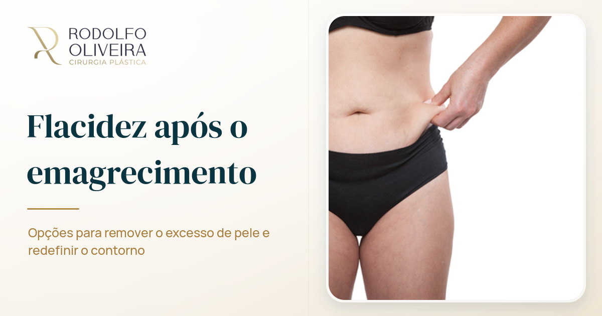 Imagem de capa do artigo Como eliminar a flacidez após o emagrecimento