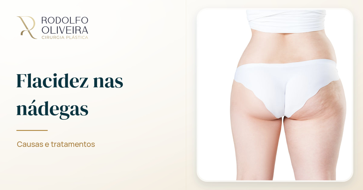 Imagem de capa do artigo Flacidez nas nádegas: causas e tratamentos