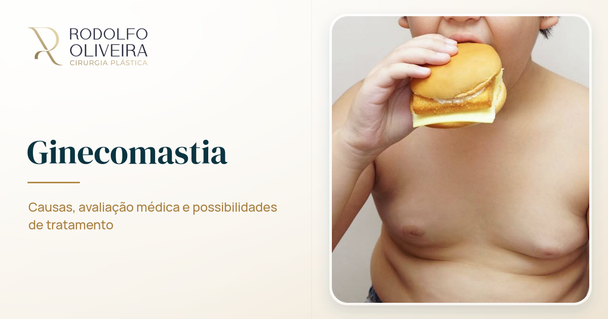 Imagem de capa do artigo Ginecomastia: o que é, causas e como tratar