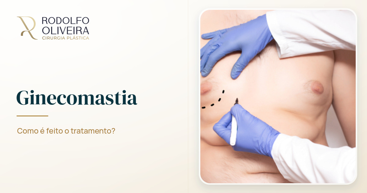 Imagem de capa do artigo Ginecomastia: como é feito o tratamento?