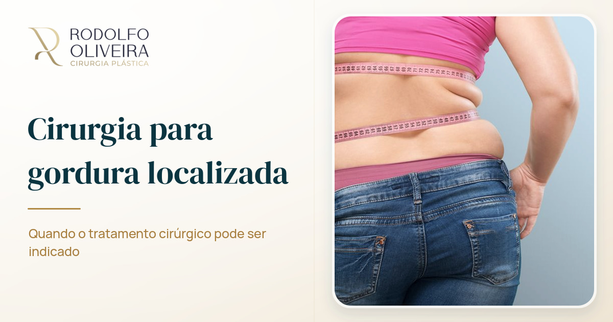 Imagem de capa do artigo Quando a gordura localizada deve ser tratada com cirurgia plástica