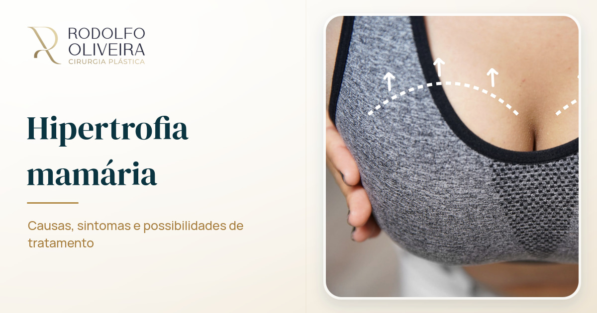 Imagem de capa do artigo Entenda o que é a hipertrofia mamária