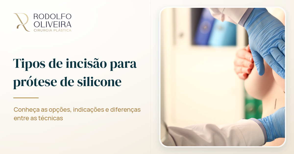 Imagem de capa do artigo Tipos de incisão que podem ser utilizadas para colocação da prótese de silicone
