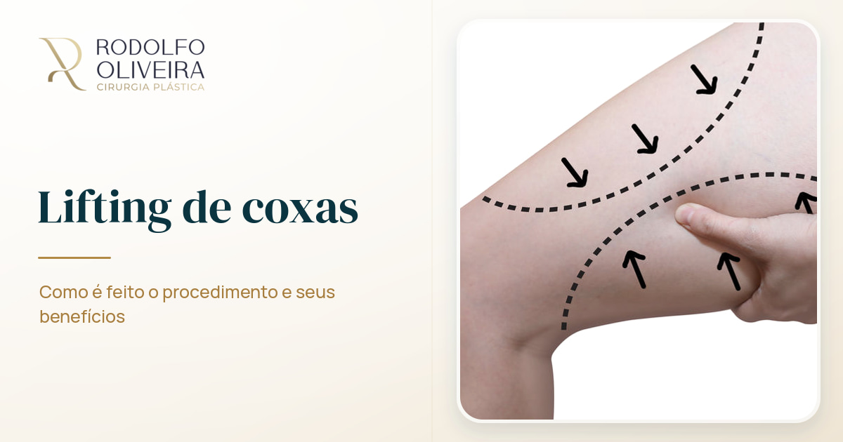 Imagem de capa do artigo Lifting de coxas: entenda como é feito o procedimento e seus benefícios