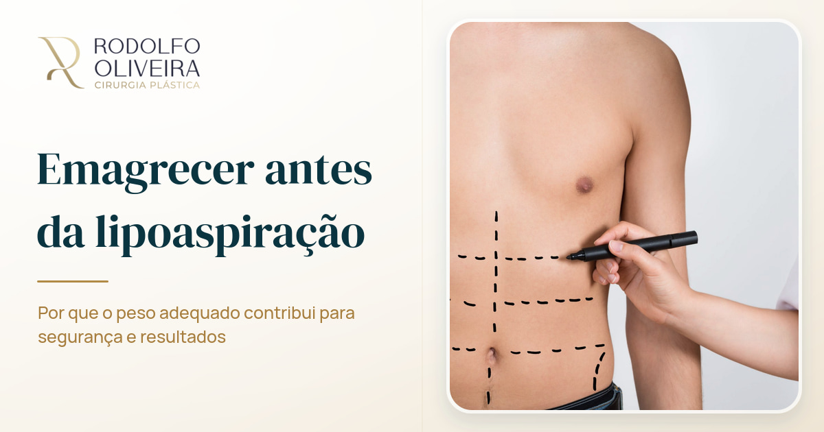 Imagem de capa do artigo Por que é importante emagrecer antes de fazer lipoaspiração?