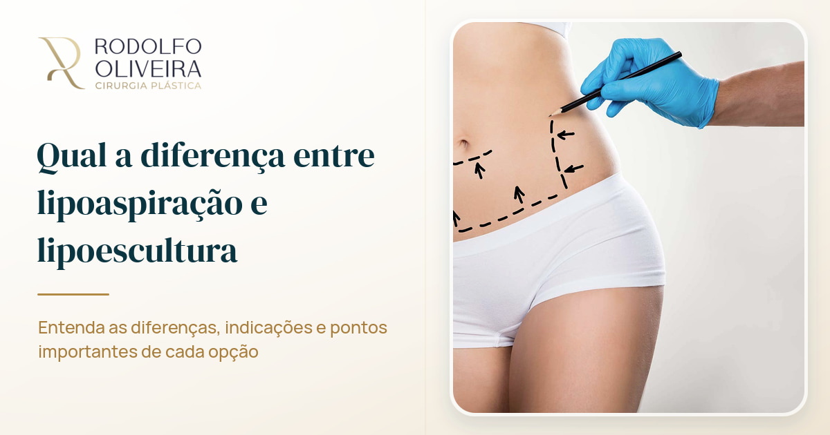 Imagem de capa do artigo Qual a diferença entre lipoaspiração e lipoescultura?