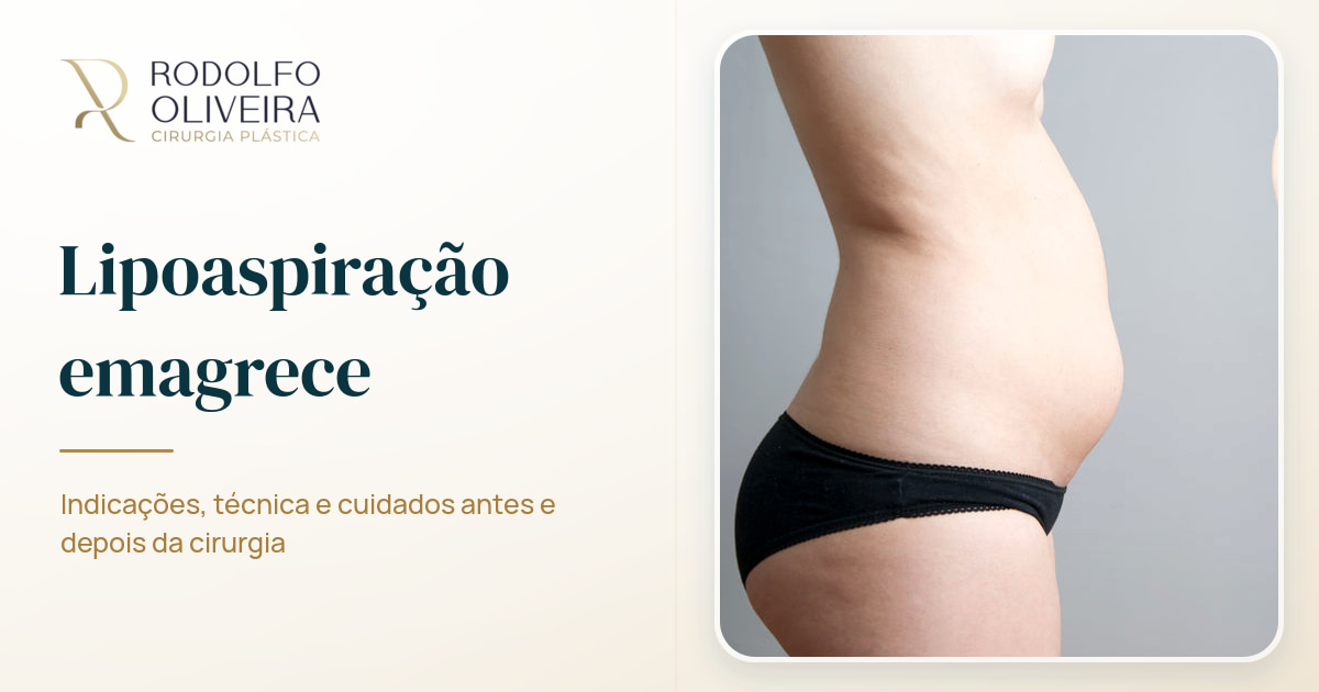 Imagem de capa do artigo Lipoaspiração emagrece?