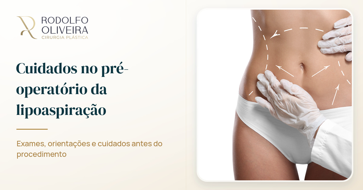 Imagem de capa do artigo Cuidados no pré-operatório da lipoaspiração