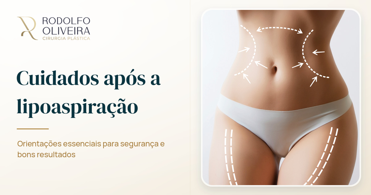 Imagem de capa do artigo Cuidados após a lipoaspiração