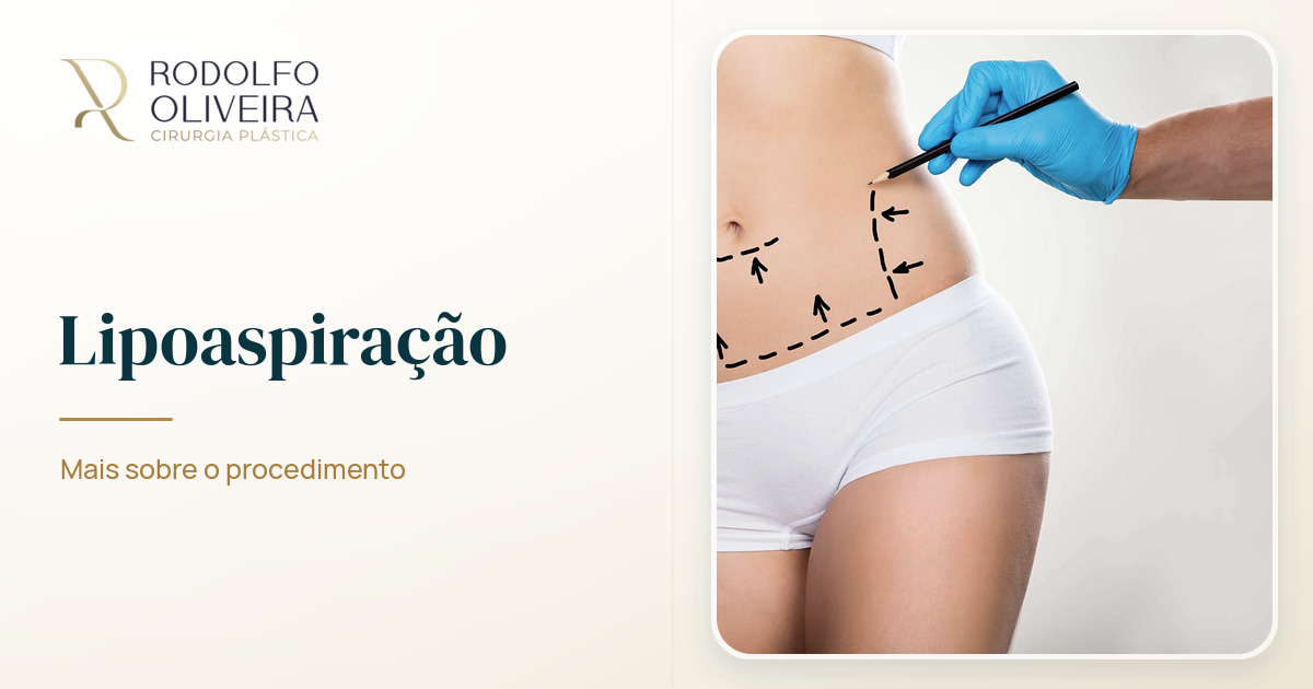 Imagem de capa do artigo Lipoaspiração: Entenda mais sobre o procedimento