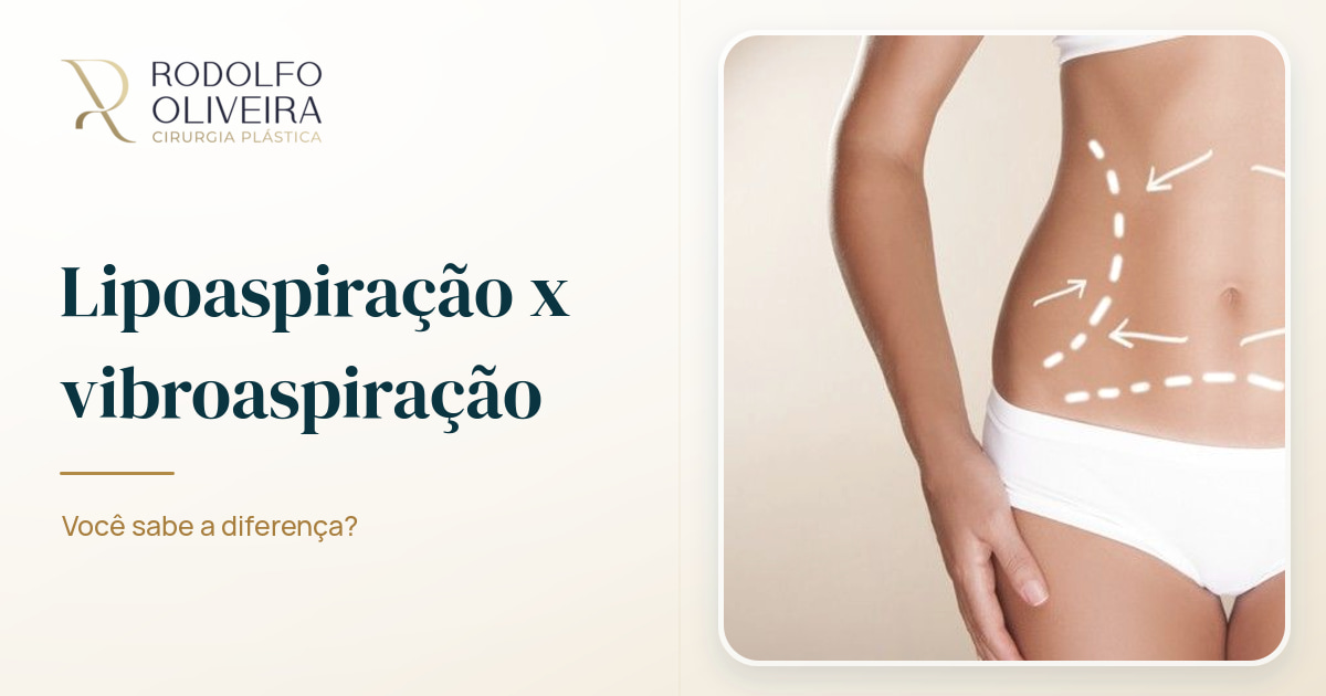 Imagem de capa do artigo Lipoaspiração x vibroaspiração: você sabe a diferença?