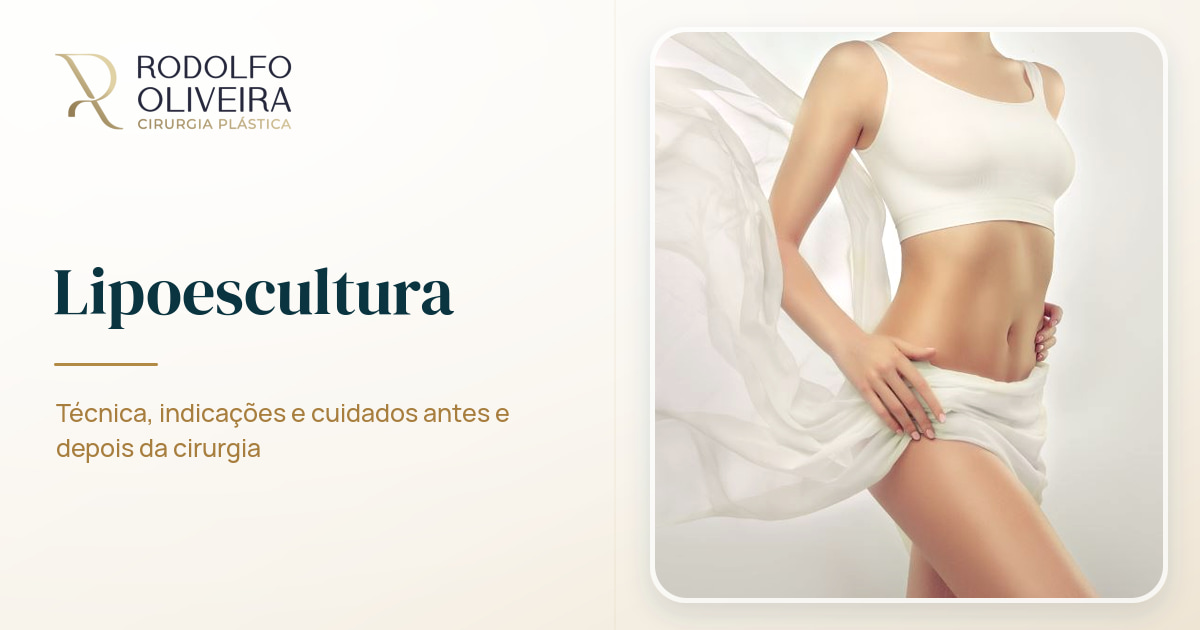 Imagem de capa do artigo Lipoescultura: tudo o que você precisar saber