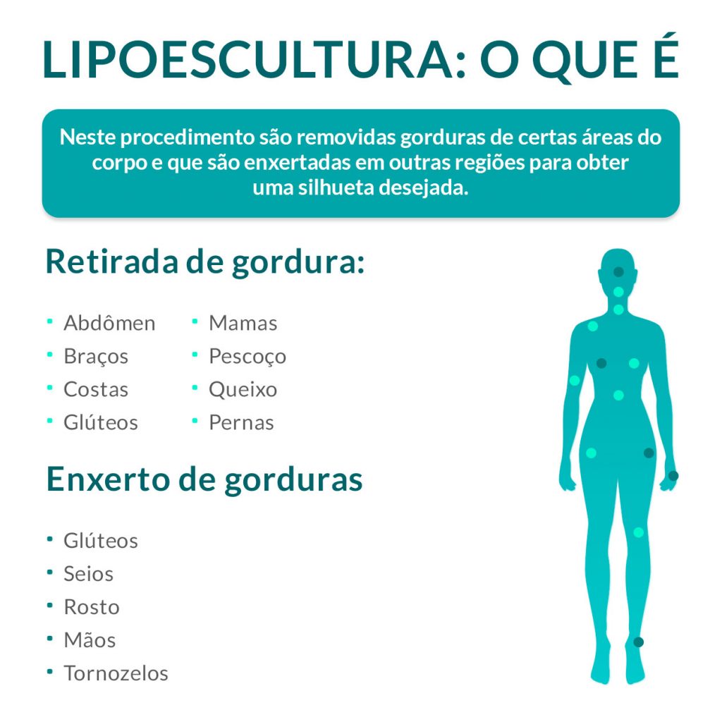 Lipoescultura: tudo o que você precisar saber