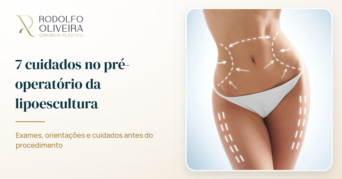 Imagem de capa do artigo 7 cuidados no pré-operatório da lipoescultura