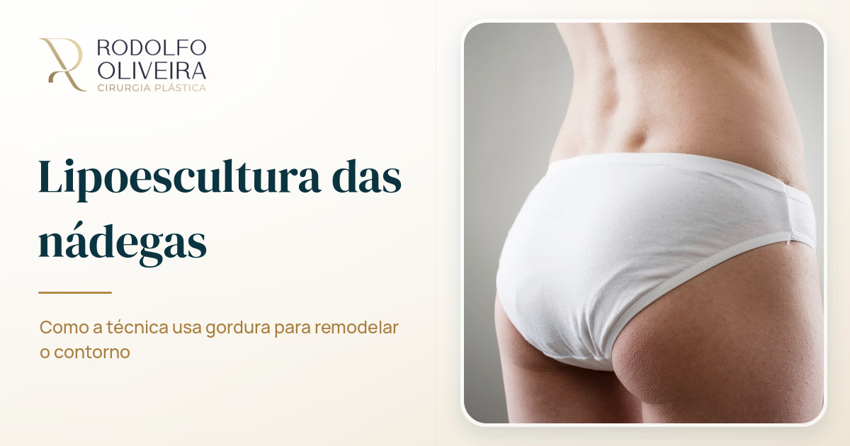 Imagem de capa do artigo Como funciona a lipoescultura das nádegas