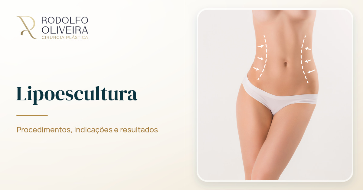 Imagem de capa do artigo Lipoescultura: procedimentos, indicações e resultados