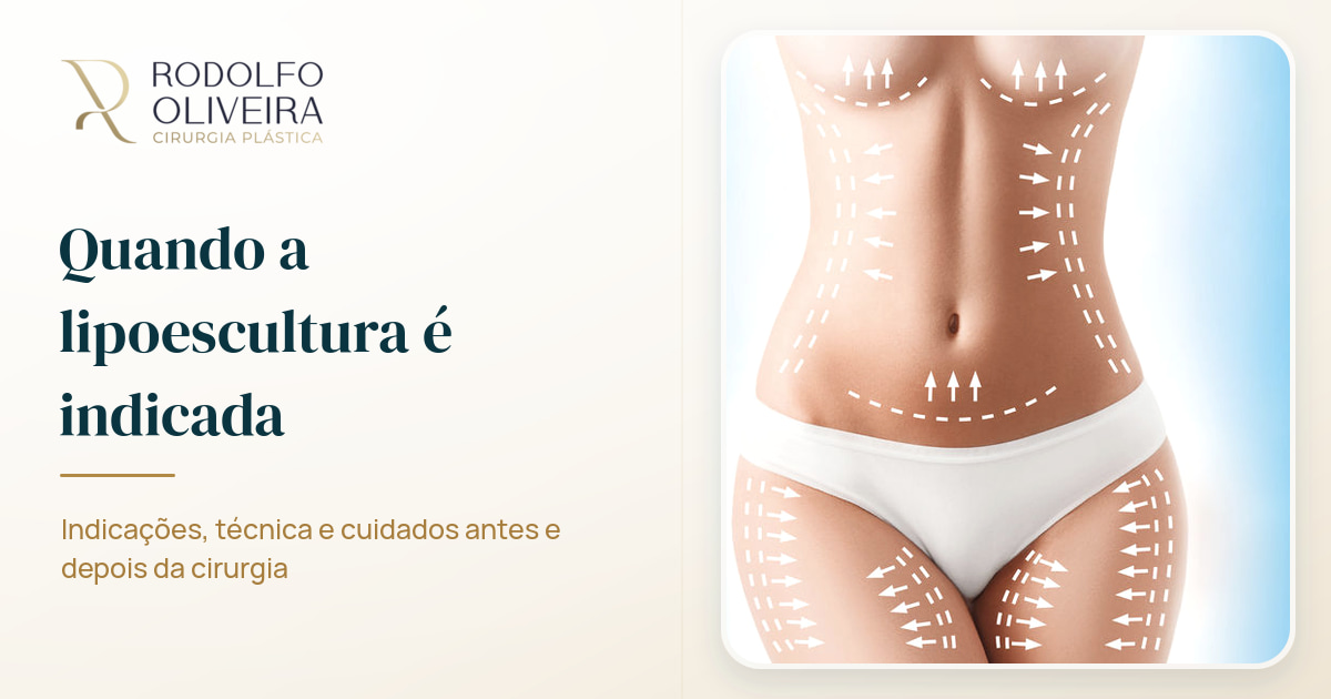 Imagem de capa do artigo Quando a lipoescultura é indicada