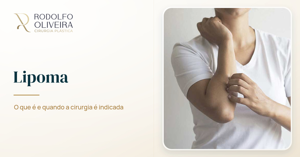 Imagem de capa do artigo Lipoma: o que é e quando a cirurgia é indicada