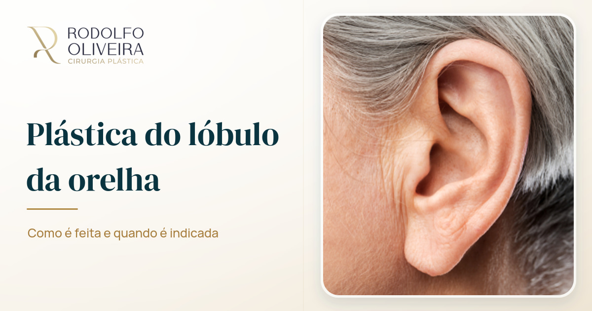 Imagem de capa do artigo Plástica do lóbulo da orelha: saiba como é feita e quando é indicada
