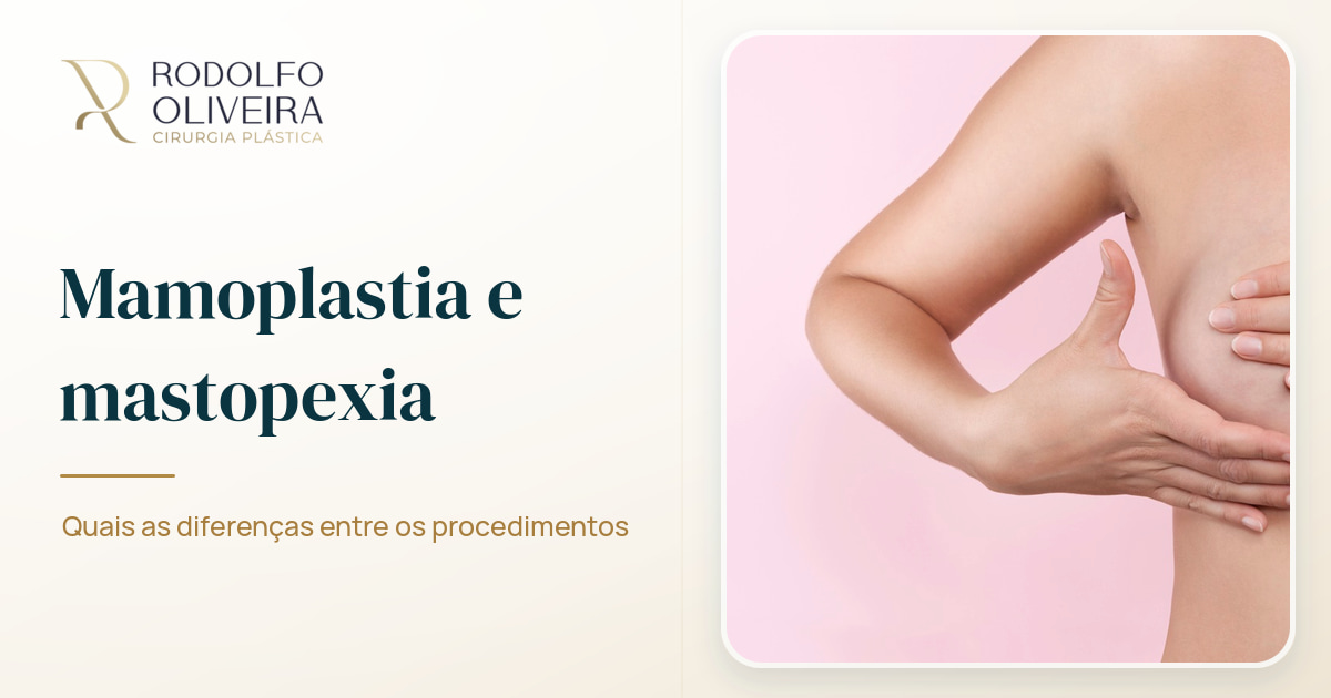 Imagem de capa do artigo Mamoplastia e mastopexia: quais as diferenças entre os procedimentos